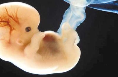 Zlikwidowano 31 amerykańskich klinik aborcyjnych